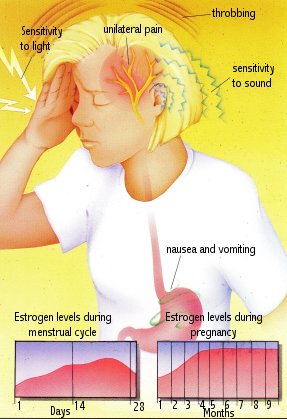 http://bigcdiscountdrugs.com/healthinformation/hipics/migraine.jpg